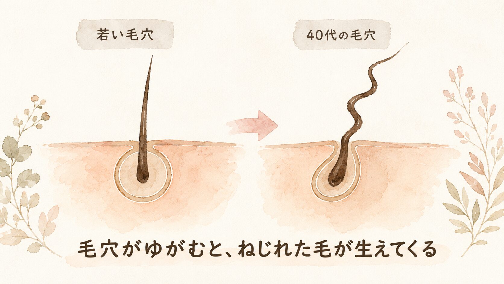 若い頃の毛穴と40代の毛穴の比較・ねじれた毛が生えてくる仕組み